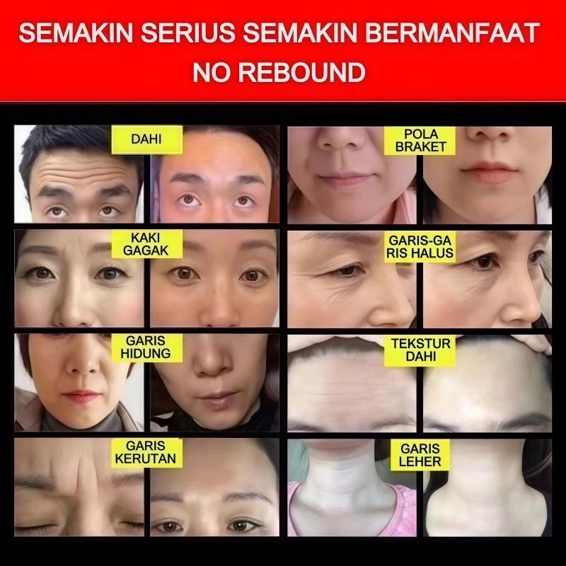 Krim Kolagen Emas 50g Krim Anti Kerut & Anti Penuaan – Melembabkan, Mengencangkan & Mencerahkan Kulit Gunakan siang dan malam untuk mengurangi garis-garis halus dan kerutan, serta melawan penuaan.