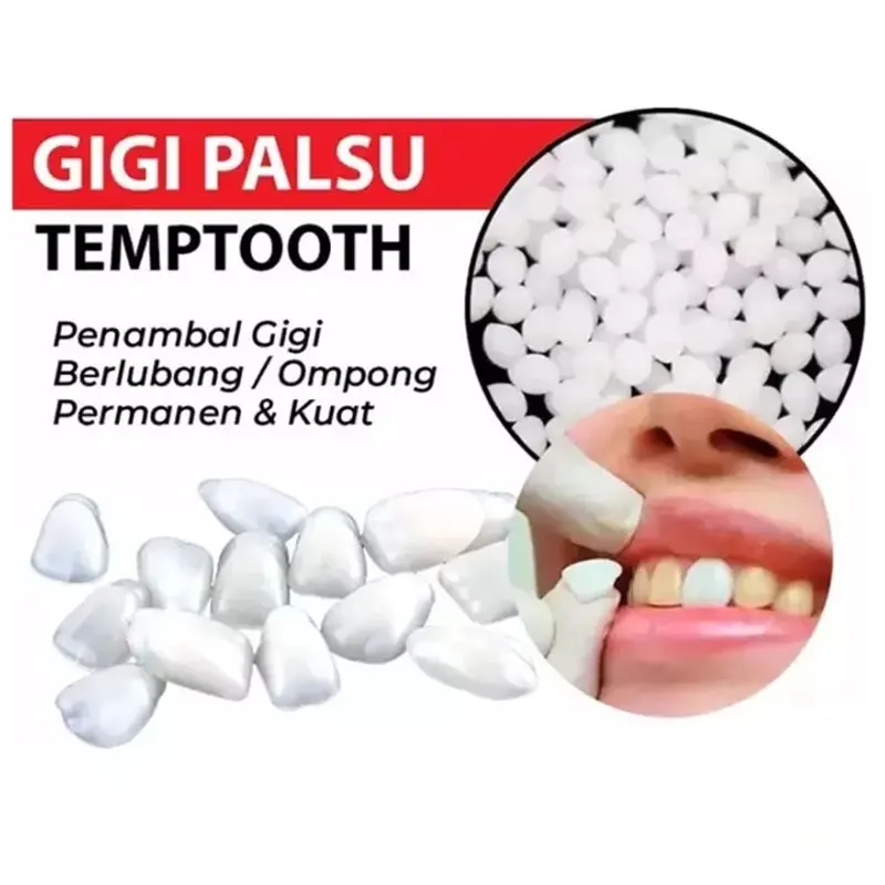 TEMPTOOTH 200 Butir Penambal Gigi Bolong   Gigi Patah   Gigi Berlubang