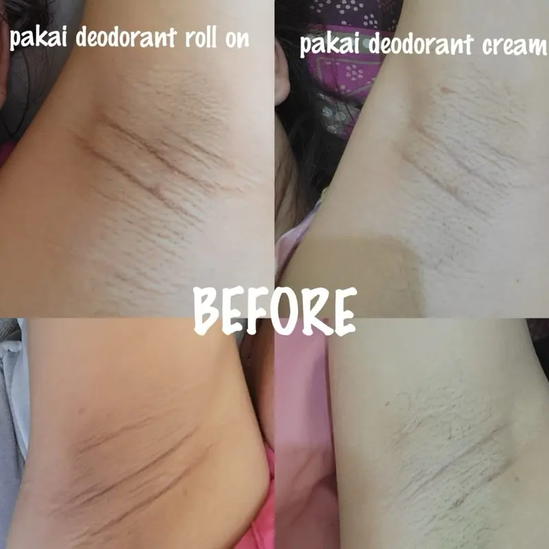 [RIKMAMU] 25ML CYPERUS ROTUNDUS OIL/HAIR REMOVAL/PERONTOK RAMBUT KETIAK 1