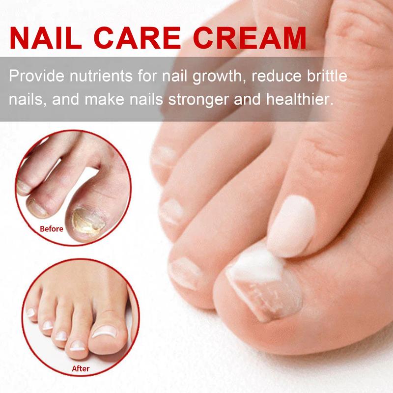 Product Introduction of Onychomycosis Repair Cream Repairs Ingrown Nails Rotten Toenails Thickening Of Nail Grooves On Hands And Feet 7