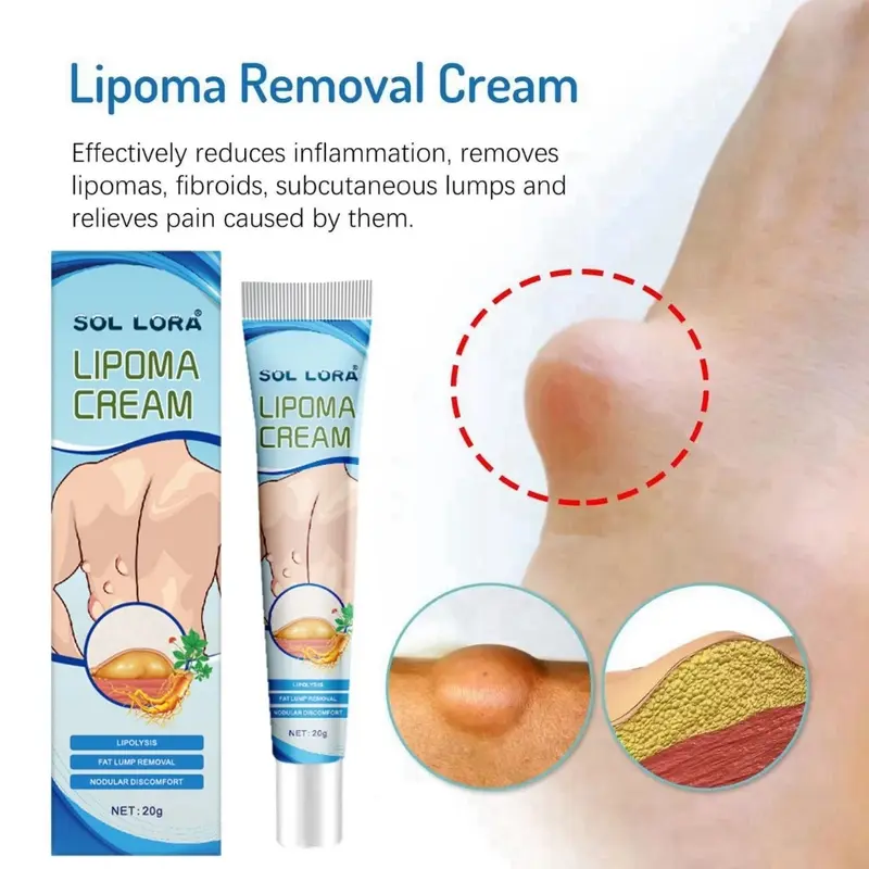 Obat Salep Benjolan Lipoma Ampuh 100% asli Obat Benjolan Ampuh Benjolan Payudara Benjolan Tangan Benjolan Leher Menghilangkan Tonjolan Meredakan Benjolan Lipoma Luar Lemak 1