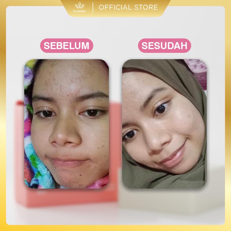 HIQWEEN RETINOL BRIGHTENING SOAP Face Facial Wash Sabun Cuci Muka Badan Retinol Memutihkan Arbutin Kotoran Membersihkan Mencerahkan Wajah Hitam 3