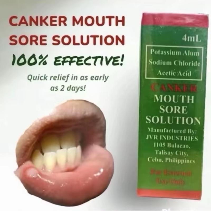 Singaw Sign Singaw Solution Canker Mouth Sore Solution Effective and Safety ...