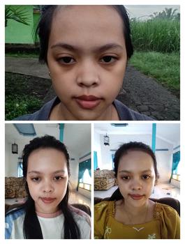 Product Review of DOSIS 2 ACNE - Paket Acne Ectoin+ Extra [for your Acne Treatment] from E**i l** M**s 0