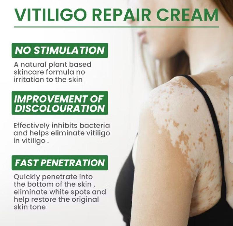 Product Introduction of krim penghilang vitiligo menghilanglan jamur panu dan mengatur pigmentasi kulit / vitiligo repair cream 18