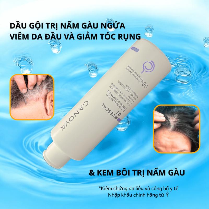 Product Introduction of Chuyên Nấm Gàu Viêm Da Tiết Bã - Dầu Gội Kem Bôi Canova Rivescal DS Nhập Khẩu Chính Hãng Từ Ý 2