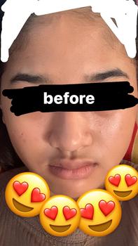 Product Review of Beauty Of Angel White Tomato Series Cream pencerah wajah melembabkan kulit kusam mengandung collagen Mencerahkan Pria Hitam Scrub Perawatan from r**˚ 2