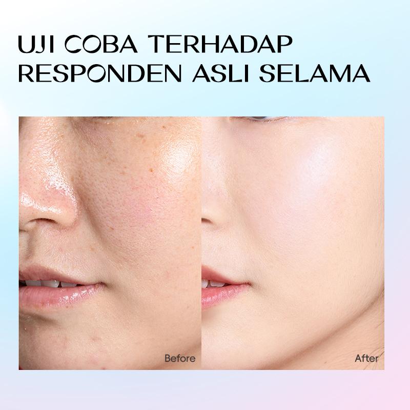 [Buy 2 Save 10% Off] ZOICY Masker Wajah Mencerahkan 2Box 10pcs - Whitening Sheet Mask | Melembapkan | Mengencangkan | Menutrisi | Menenangkan | Anti Kerut | Glowing | Niacinamide | Hyaluronic Acid | Salicylic Acid | Witch Hazel | Extract Centella Purslane