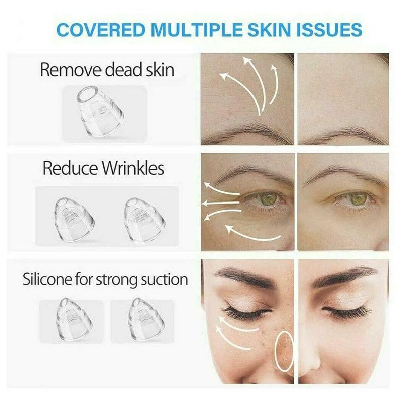 Alat Penyedot Komedo dan Jerawat Vacum Alat Facial Perawatan Wajah 4