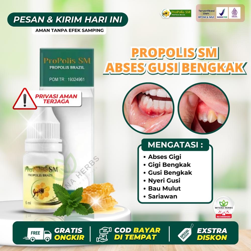 Propolis Sm Atasi Abses Gigi, Gigi Bengkak, Gusi Bengkak, Nyeri Gusi, Bau Mulut dengan Propolis SM  Perawatan Gigi dan Mulut isi 6ml