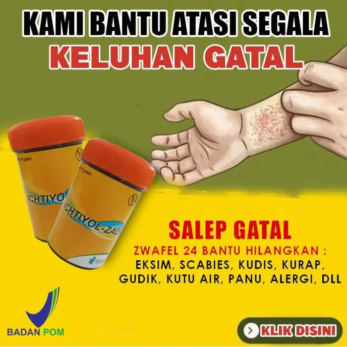 (Paket 2PCS) Salep Belerang Zwafel 24 Nufarindo BPOM mengatasi Panu Kadas Kurap Eksim Alergi Kutu Air dan Jamur
