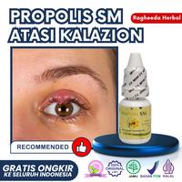 Gambar Obat Mata Kalazion - Benjolan Di Kelopak Mata - Mata Bintitan - Mata Bengkak - Propolis Sm Brazilian dari Ragheeda Herbal Kota Administrasi Jakarta Barat 1 Tokopedia
