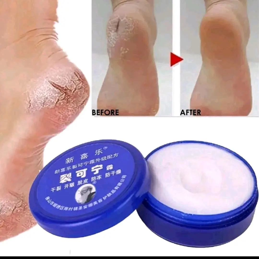 Krim Herbal China Menghaluskan Melembutkan Kaki dan Tangan Herbal Foot Cream Perawatan Mengelupas