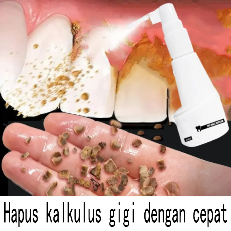 Pembersih karang gigi Penghilang karang gigi membandel  alat pembersih karang gigi 30ml Pemutih Gigi Kuning Kerak Penghilang Karang Permanen Ampuh Teeth Whitening Menghapuskan plak gigi dan noda asap menghapuskan bau mulut Memutihkan