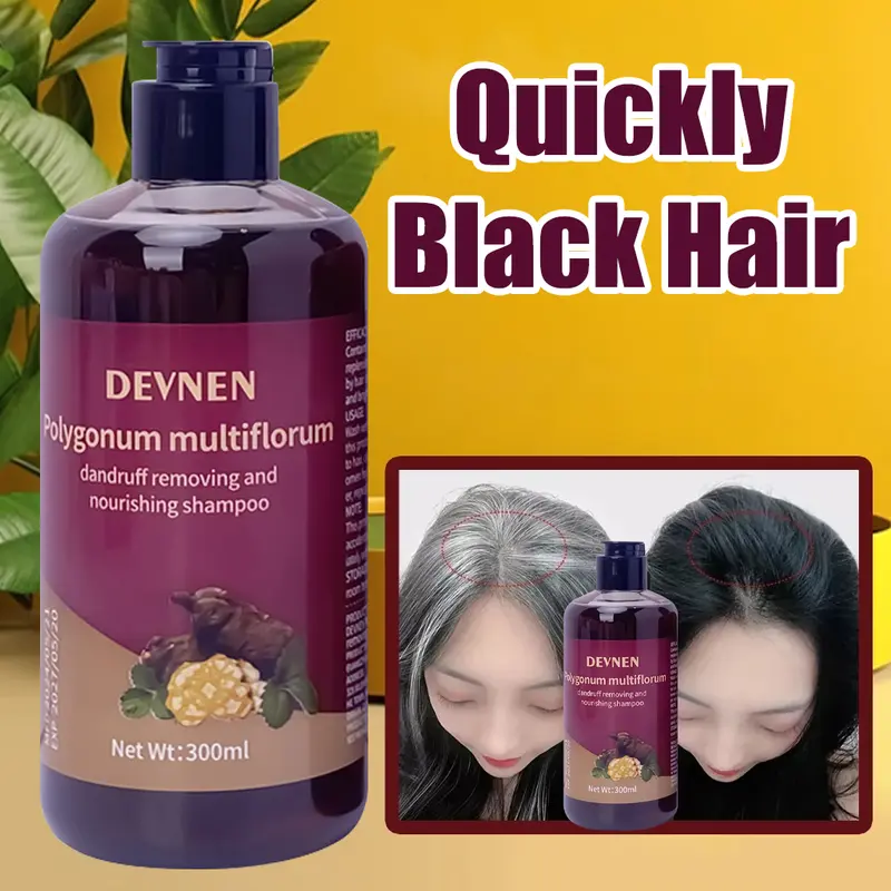 SHAMPO Black Herbal Natural Penyamar Rambut dan Penghiang uban Usia Muda 300ml Shampoo Herbal Polygonum Penghitam Rambut Hitam Dalam Sampo Ketombe Sampo Menghitamkan  Conditioner 4
