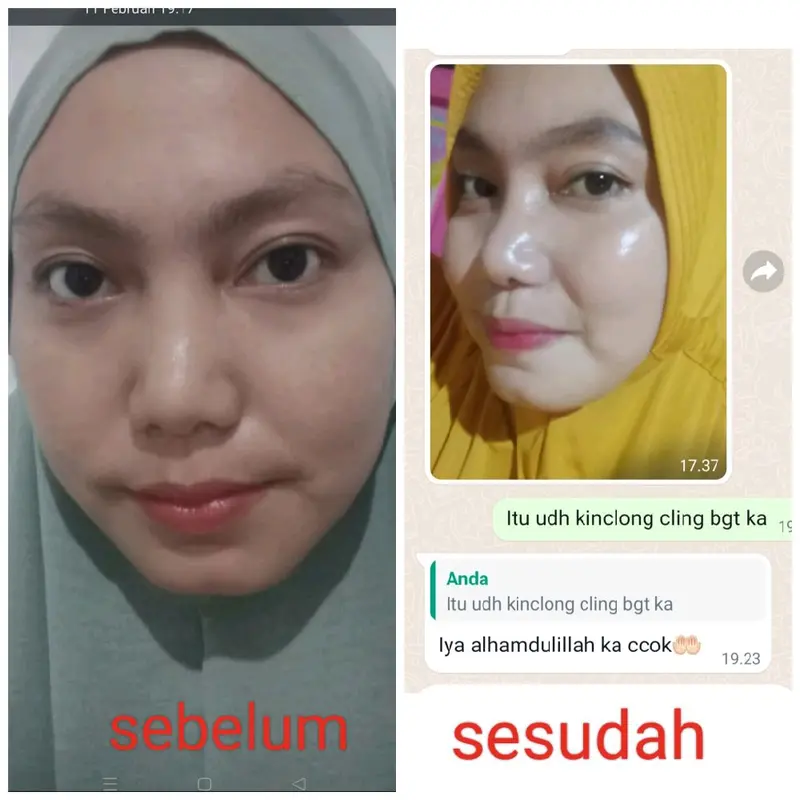 paket whitening kulit sensitif 3