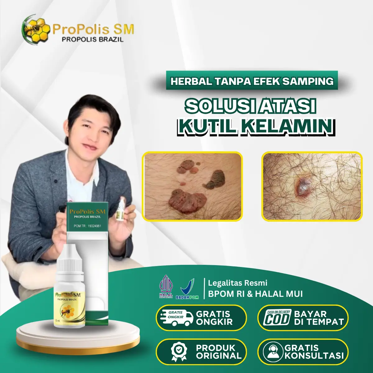 Penghilang Kutil Kelamin, HPV, Gatal Kelamin, Kelamin Lecet, Perontok Kutil Kelamin Dengan Propolis SM
