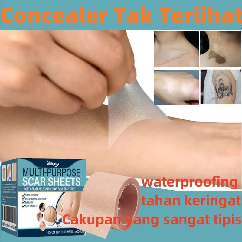 Silicone Scar Sheet penghilang bekas luka plester keloid penutup luka warna kulitstretch mark operasi cesar tanda lahir bekas jerawat scar removal cream tambalan concealer penutup tattoo