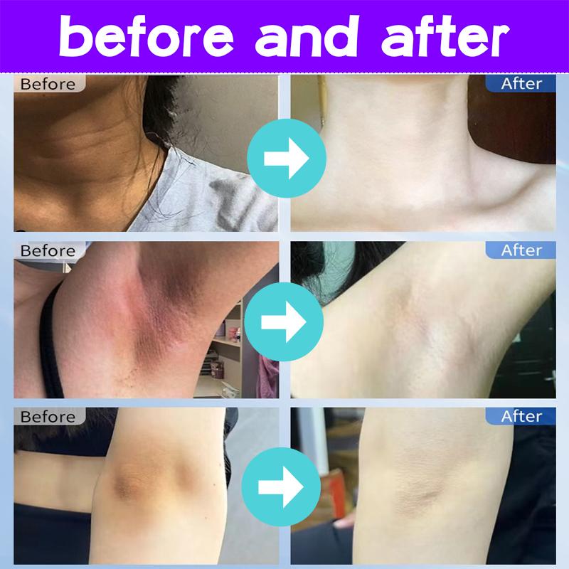 Whitening Cream  pemutih ketiak hitam krim ketiak selangkangan Underarm Cream Whitening Krim Cream Pemutih  Badan Ketiak Leher Pantat dan Selangkangan Sangat  50g sabun  pemutih 5