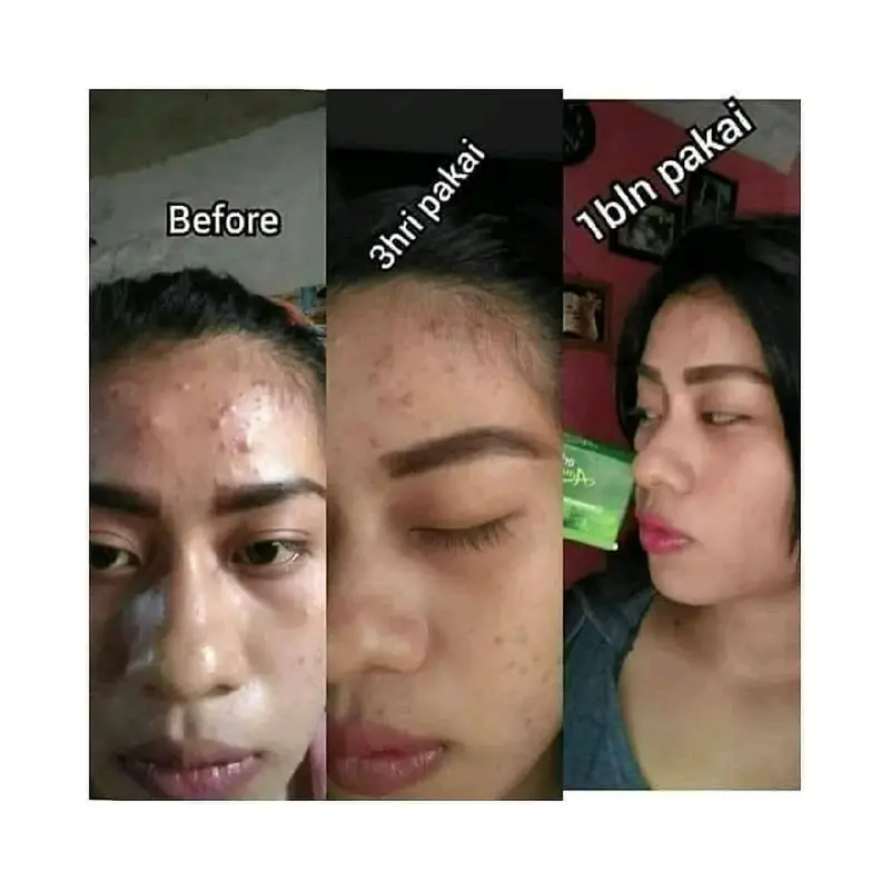 Sabun Wajah Erhsali Acne Soap Eaafs Original Nasa perawatan jerawat 6