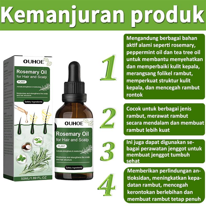Product Introduction of Rosemary hair oil hair tonic penumbuh rambut dengan cepat dan botak tebal serum rambut rontok Hair growth serum Minyak 20
