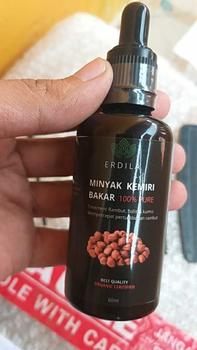 Product Review of Minyak Kemiri bakar murni Erdila penumbuh rambut 100% PURE ORIGINAL Menebalkan Menumbuhkan from S**o 1