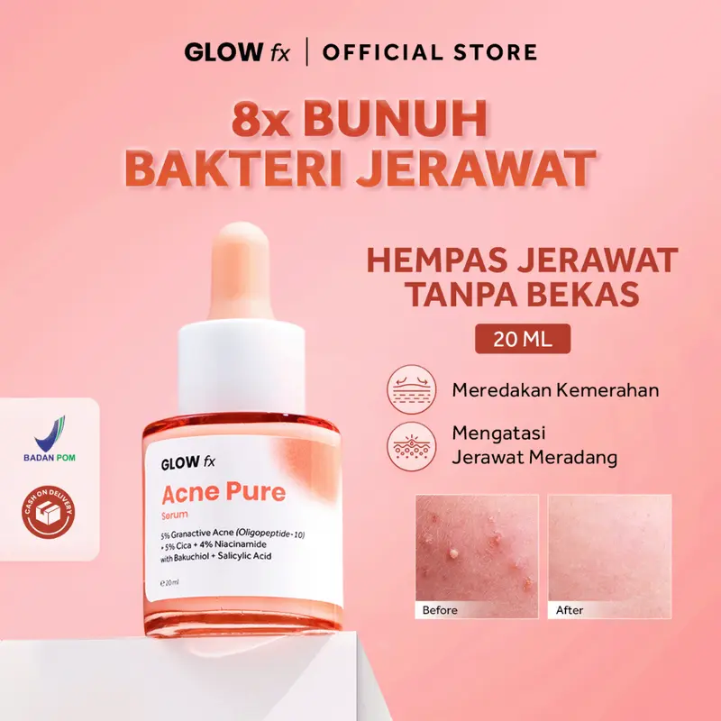 GLOW FX Glow Bomb Serum | Acne Pure Serum - GLOW FX Acne Pure Serum Glowfx glowbomb Mencerahkan Wajah Memudarkan Berjerawat 4