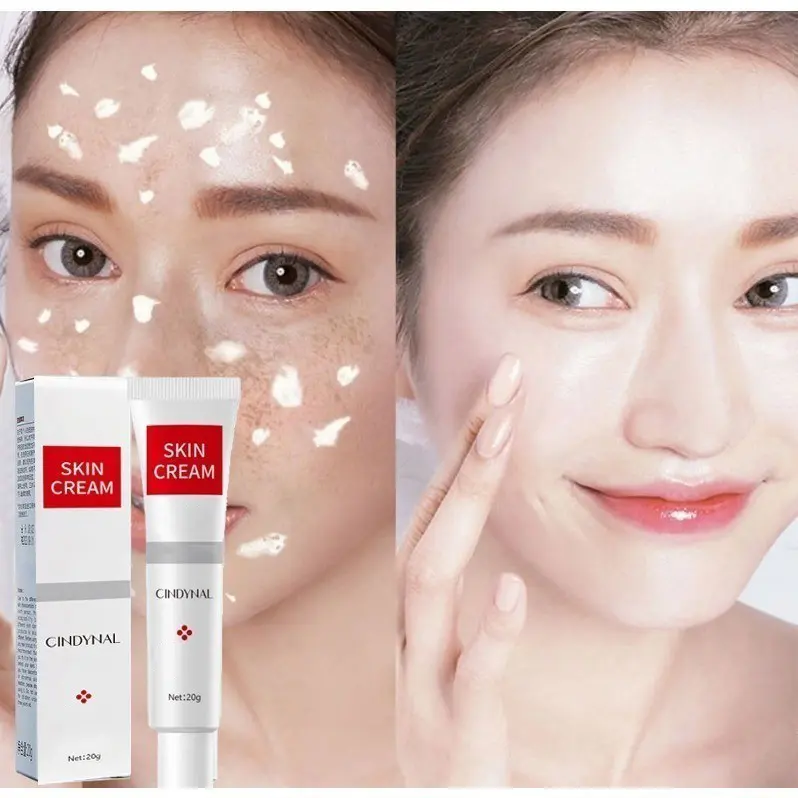 BPOM CINDYNAL Skin Cream Removal Dark Spots Krim Wajah Brightening Pencerah Bintik Flek Hitam 20gr Default