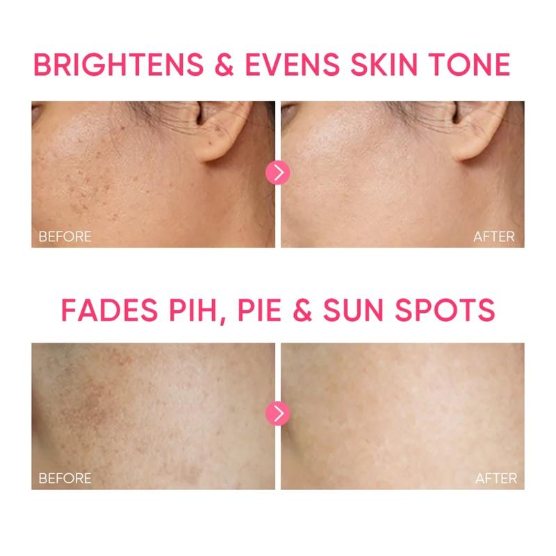 Product Introduction of SKINTIFIC MSH Niacinamide whitening Gel moisturiser Glowing Moisturizer Fades Dark Spot Cream 0
