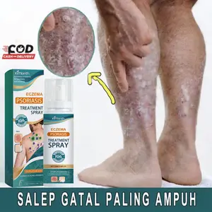 Spray Anti Gatal Eksim 100ML - Anti Jamur, Untuk Selangkangan, Kelamin, Bokong
