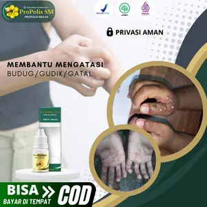 Propolis - atasi gatal bernanah, gudik budug, Gatal parah, Gatal santri, gatal berair, gatal seluruh tubuh Isi 6 ml Sudah Bpom dan Halal, Penggunaan Dioleskan Bukan Salep