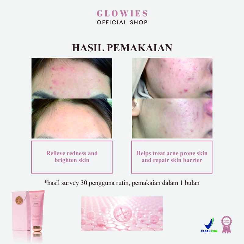 BEST DEAL | GLOWIES BEAUTY Dreamy Moisturizer Pelembab Wajah Skin Barrier Moisturizer 80 ml Acid Ceramide Hyaluronic Acid Kusam Niacinamide Alpha Arbutin aman untuk kulit Berjerawat Membantu Mencerahkan Tranexamic Acid 4