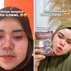 RETINOL BOOSTER UTUK FLEK MEMBANDEL MENCERAHKAN DAN MENGGLOWINGKAN MENGHILANGKAN JERAWAT