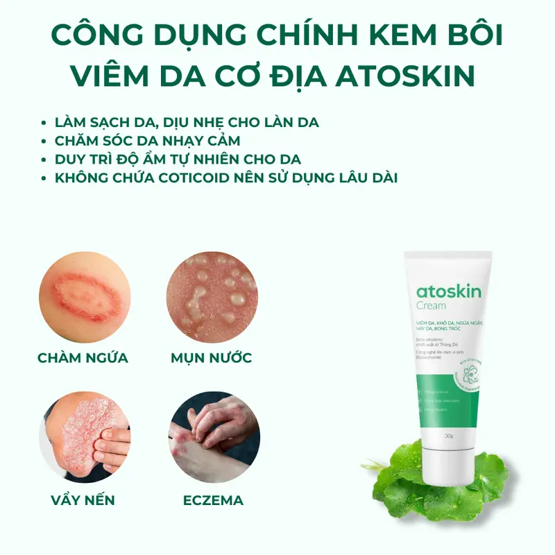 (Combo 2) - Kem Dưỡng Atoskin 30g Hỗ Trợ Giúp làm dịu da khi bị: Viêm da, ngứa ngáy, khô da, vảy da, bong tróc 50g 2