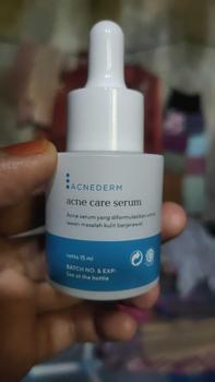Product Review of WARDAH 5% Azeclair + Salicylic Acid serum Acnederm Acne Care 15 ml - Serum dengan Tea Tree Oil - Serum Jerawat dan Mencerahkan Kulit - Menyamarkan Noda Bekas, Mengurangi Minyak Berlebih - Skincare from h** 1