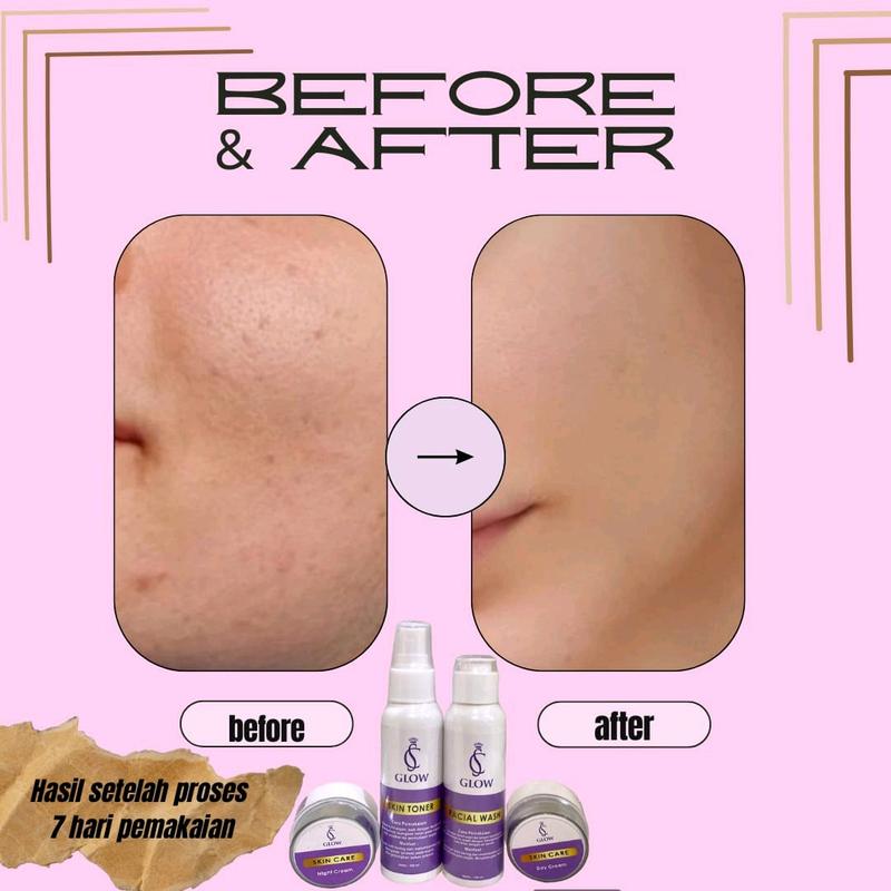Paket Perawatan Wajah CS GLOW SKINCARE ORIGINAL untuk Mencerahkan dan Memudarkan Kerutan - Hitam, Facial 6