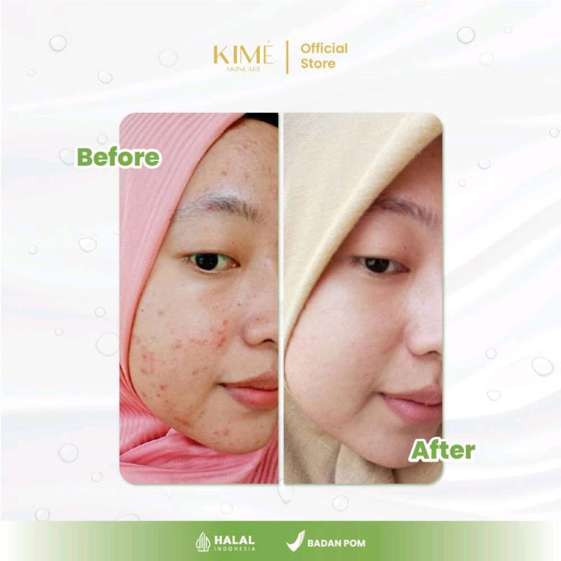Sabun Kime Luminizing Jeju Brightening Soap Beauty Mencerahkan Kulit Tubuh 3
