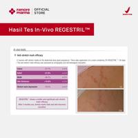 Gambar Bundling Stretch Mark & Intimate Health | Membantu Perawatan Lengkap dari Ujung Kepala hingga Ujung Kaki serta Area Kewanitaan - Regular dari Filmore Pharma Kota Bekasi 5 Tokopedia