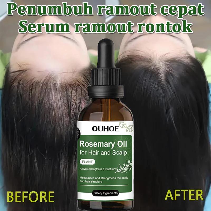 Rosemary hair oil hair tonic penumbuh rambut dengan cepat dan botak tebal serum rambut rontok Hair growth serum Minyak 0