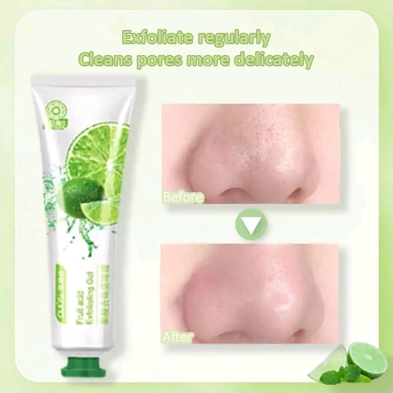 OULISI Fruit Acid Exfoliating Gel Facial Mengangkat Kulit Mati Cleanser Muka Mencerahkan Wajah Cleansing Bersihkan Kotoran 5