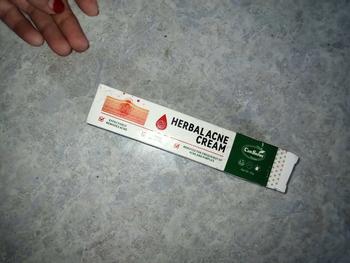 Product Review of （T1）BPOM.Beli 2 Gratis 1.Challenge 7 Hari Jerawat Hilang,CINSULIN Obat Jerawat Herbal Ekstrak Alami Cepat Hilangkan Komedo & Jerawat Meradang  BPOM Certified  Aman untuk Remaja & Kulit Sensitif Berjerawat Wajah Gatal Beruntusan from u**a 0