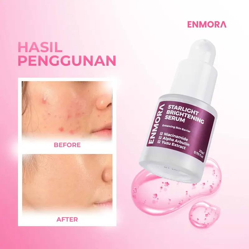Enmora Starlight Brightening Serum Pencerah Wajah dengan Niacinamide, Alpha Arbutin dan Yuzu Extract - Mencerahkan Muka 6