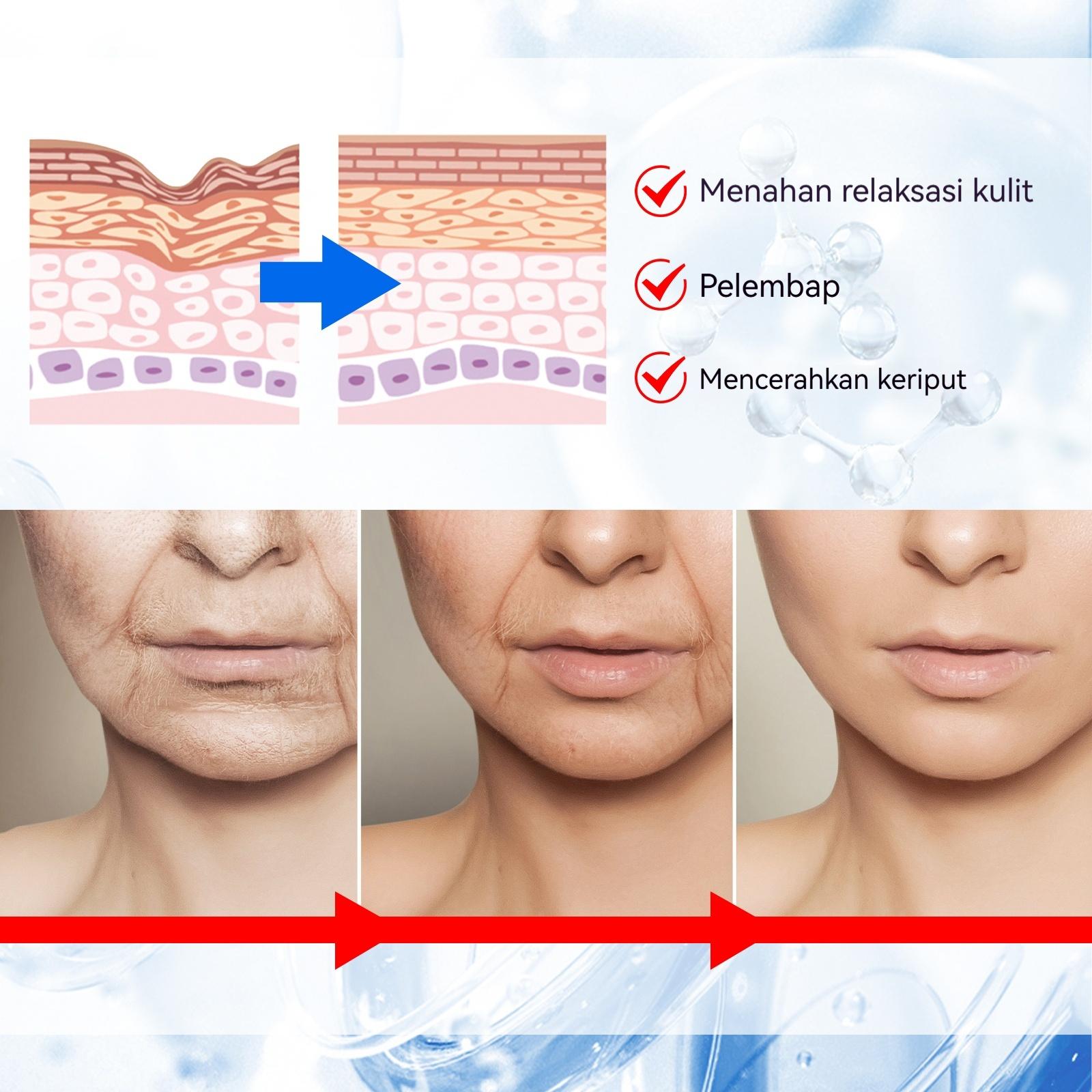 Krim esensi anti kerut air bersinar. Krim esensi ini dapat menghaluskan garis halus, melembapkan dan mengencangkan kulit-YY