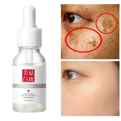LS [ PAKETAN ] Penghilang Flek Hitam 2 in 1 Fuyan Cream Whitening Remove Dark Spot & Serum FuYan Penghilang Flek Hitam Kerutan Kuning 1