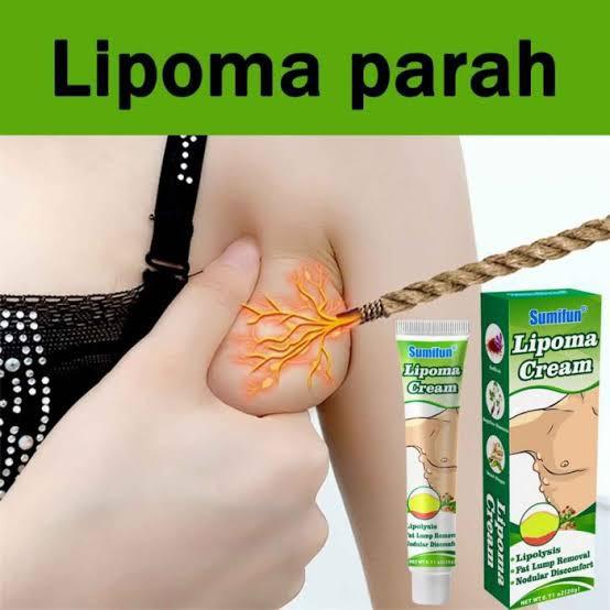 Product Introduction of sumifun lipoma solusi ampun menghilangkan benjolan 5