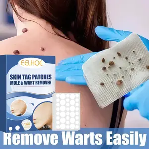 EELHOE Penghilang Kutil Patches Skin Tag Patches Wart Corn Patch Anti-wart Penghilang Tahi Lalat  Remove Warts Easily