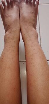 Product Review of ESASKIN (Paket) Peeling Spray dan Body Serum - Spesial Kulit Belang Mencerahkan Tubuh Serum Badan Kaki tangan from c**🦩 2