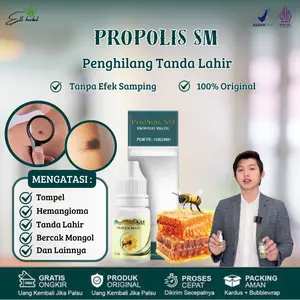 Obat Penghilang Tompel, Tanda Lahir Hitam,Coklat, Merah, Hemangioma, Bercak Mongol, Menghilangkan Tanda Lahir Di Seluruh Tubuh, Penghilang Tanda Lahir Pada Bayi Dengan Propolis SM