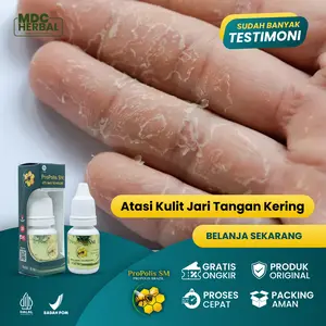 Herbal Jari Tangan Kering Pecah Pecah, Tangan Alergi Sabun Deterjen, Kulit Mengelupas, Jari Luka Dan Perih, Telapak Tangan Kasar, Kapalan - Propolis SM Ekstrak Propolis Brazil
