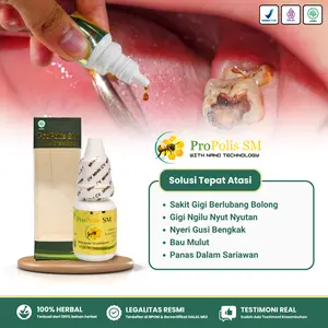Propolis SM 6ml - Tetes Kumur Sakit Gigi Berlubang Nyeri Gusi Bengkak Penghilang Bau Mulut Karang